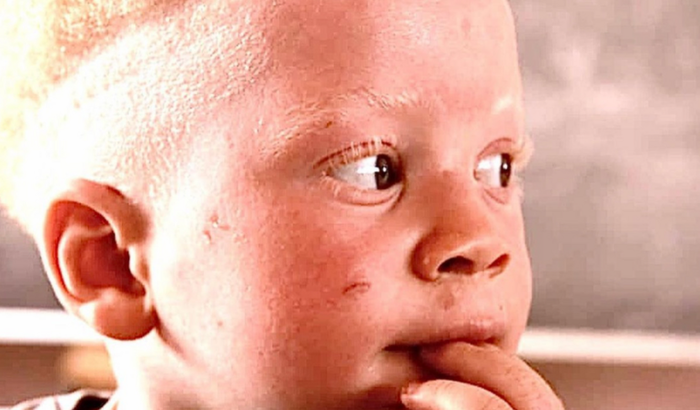 Oi Vida para Aldeia Nissi