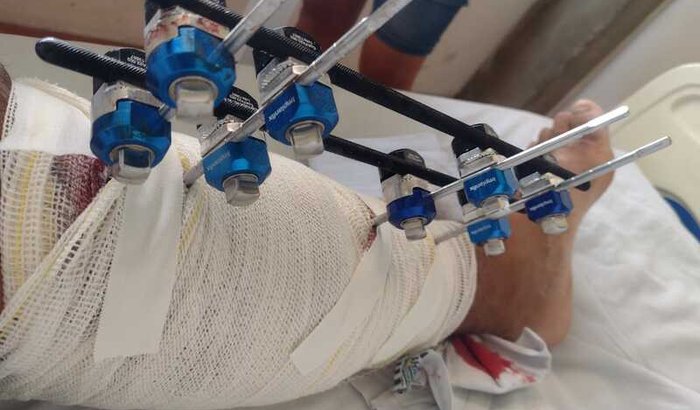 Pós cirurgico para um trabalhador autonomo 