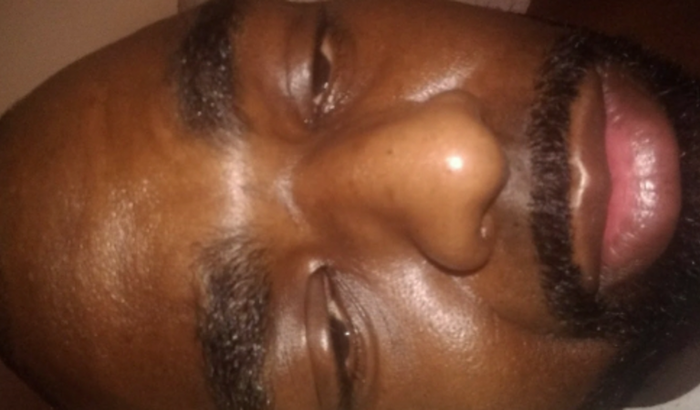 Ajuda Wellington grande homem com câncer no estômago