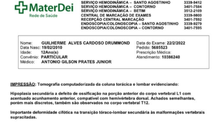 CIRURGIA DE HEMIVERTEBRA DO GUILHERME