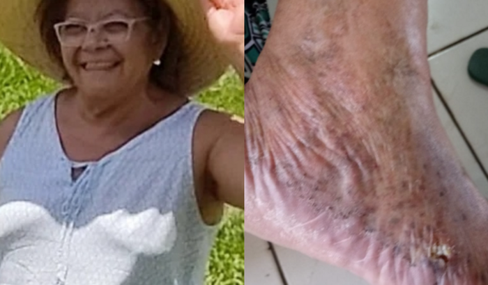 Ajuda para o tratamento da Dona Célia, minha mãe