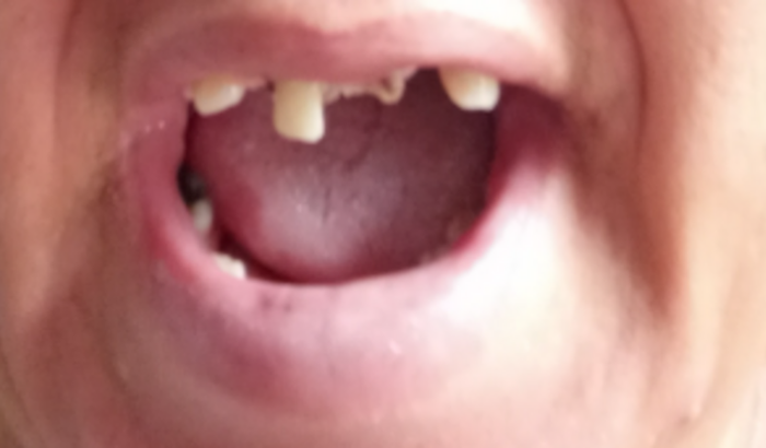Tratamento odontológico