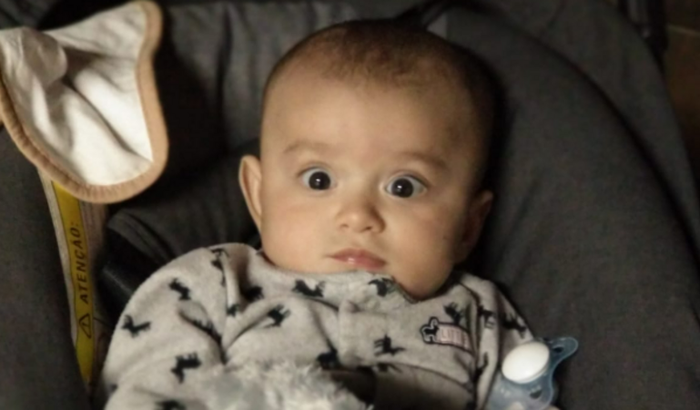 Tratamento Assimetria Craniana do nosso Bebê Henry