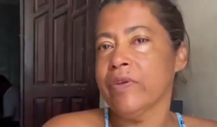 Ajuda com a cirurgia de tromboze ocular de Célia pascifico