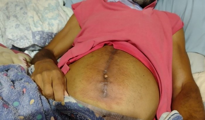 Ajude no Tratamento de Câncer de Intestino Metastático Avançado