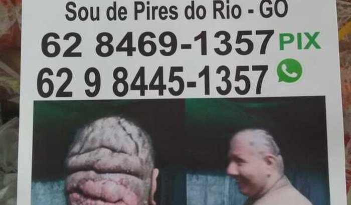 Me ajuda a salva a vida do meu filho ele precisa  fazer uma cirurgia  com urgência 