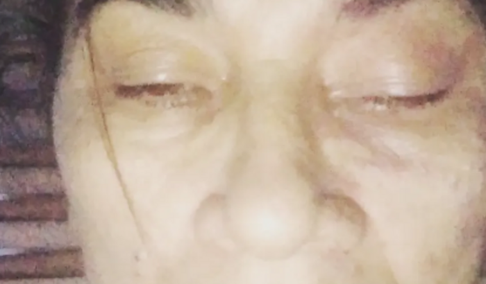 glaucoma preciso de um óculos  novo pra poder enxerga melhor 