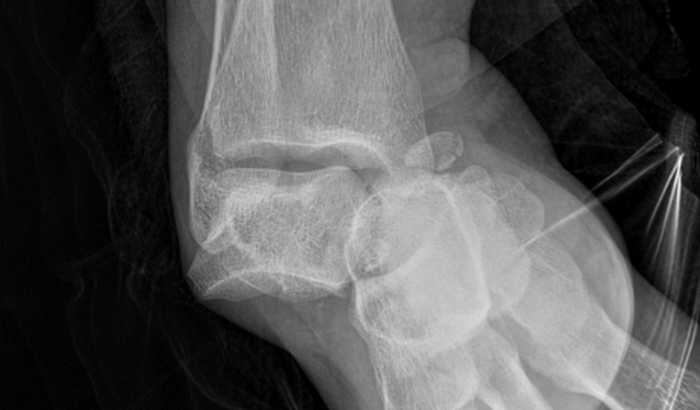 Prof. Jéssica pede ajuda! Cirurgia ortopédica de urgência