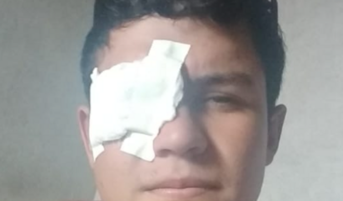 Ajuda para Weslei cirurgia de córnea