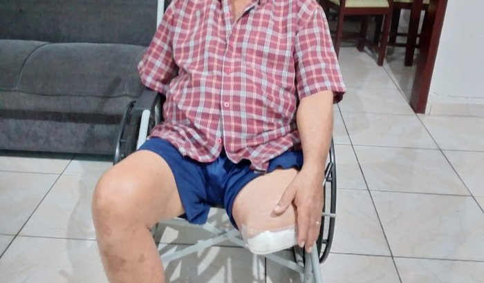 Prótese para meu avô