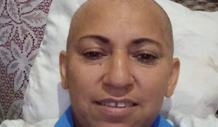 TRATAMENTO ONCOLÓGICO DALCINA