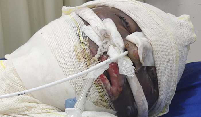 Meu filho corre risco de óbito ajuda pra eu esta indo ao hospit