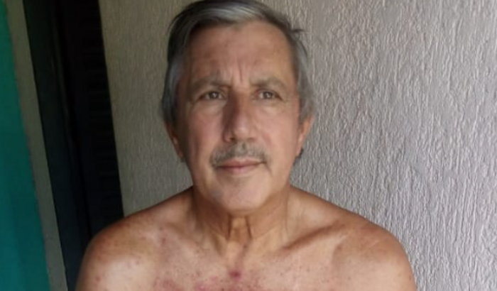 Tratamento de saúde para o Sgt Rodovalho 