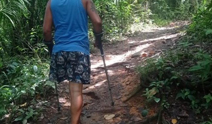 Ajuda🦿 Perna mecânica🙌