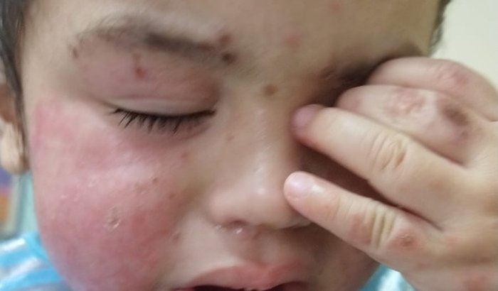 Ajuda para comprar o leite neocate