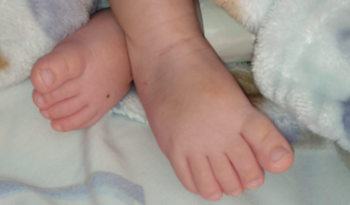 Ventilador CPAP João Pedro