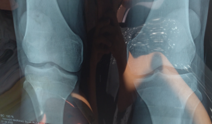 Ajude a pagar minha fisioterapia para que eu possa ser um atleta saudável 