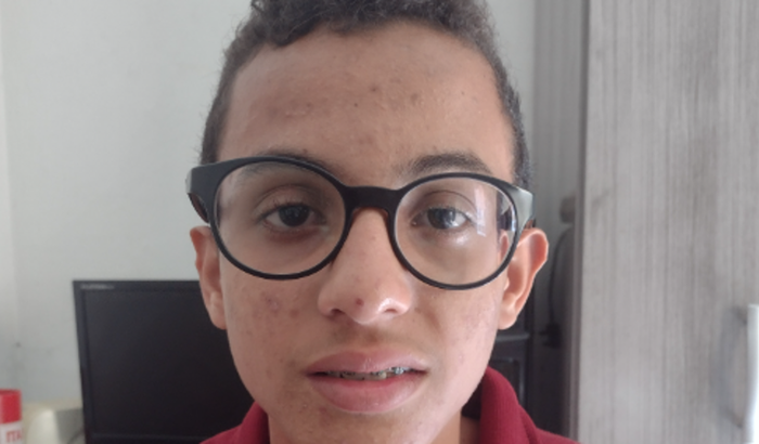 Ajuda para cirurgia do Alexei😔