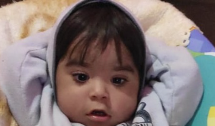 Davi de 1 ano 8 meses precisa fazer um exame de análise de expressão genética por locous