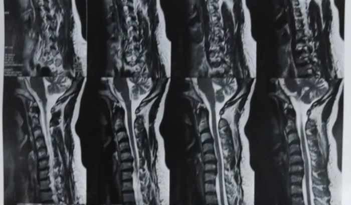 Urgente cirurgia cervical de nossa amiga Sandra