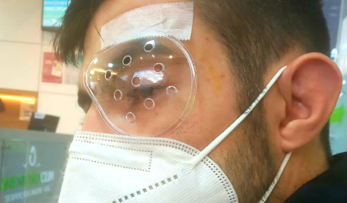 Cirurgia para o Eugênio enxergar 👁