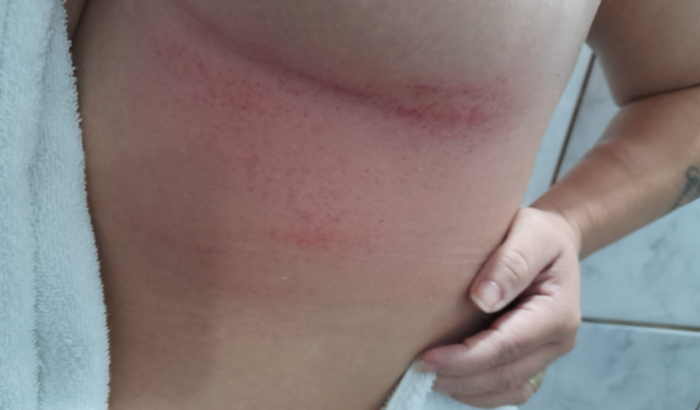 Agressão contra Mulher