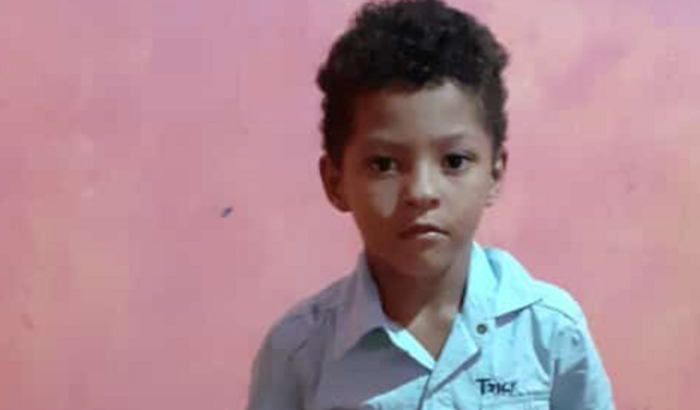 Tratamento do Enzo 