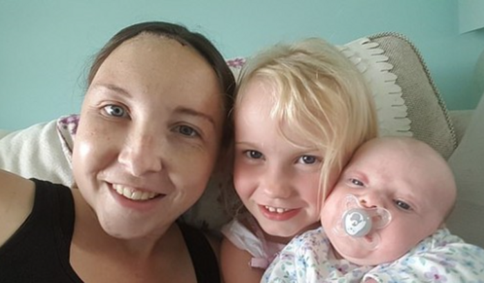 Ajudem a cirurgia de hidrocefalia para Fabiana