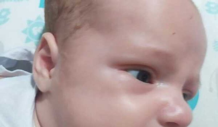 ÓRTESE CRANIANA BRYAN URGENTE
