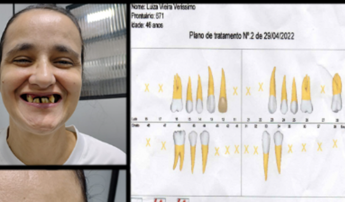AJUDA PARA TRATAMENTO DENTÁRIO PARA A LUIZA