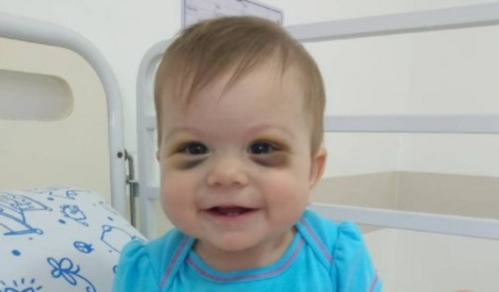 Tratamento de Câncer Helena