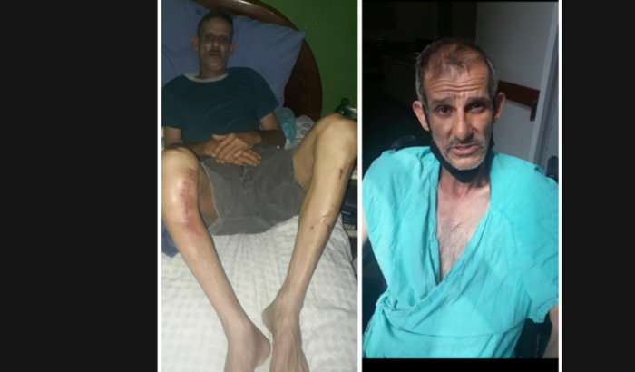 Amilton apelido TETI do Lauzane Paulista