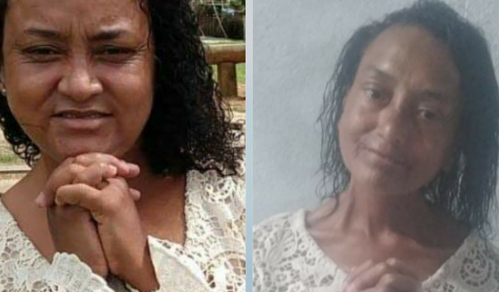 OS ESTRAGOS DA ESCLEROSE SISTÊMICA E AINDA SONHAR 