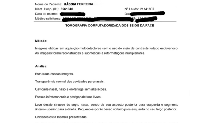 Cirurgia extremamente necessária de desvio de septo por causa da sinusite
