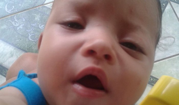 Tratamento Bebê Bernardo