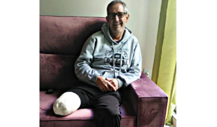 Protese de perna altura coxa e reabilitação