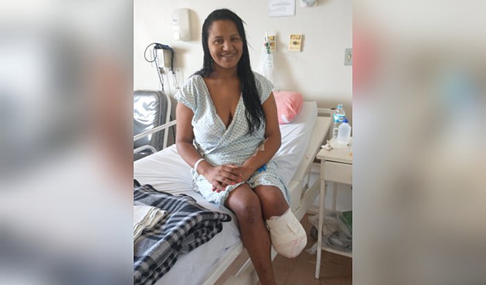 Prótese para Bruna(Brunão)