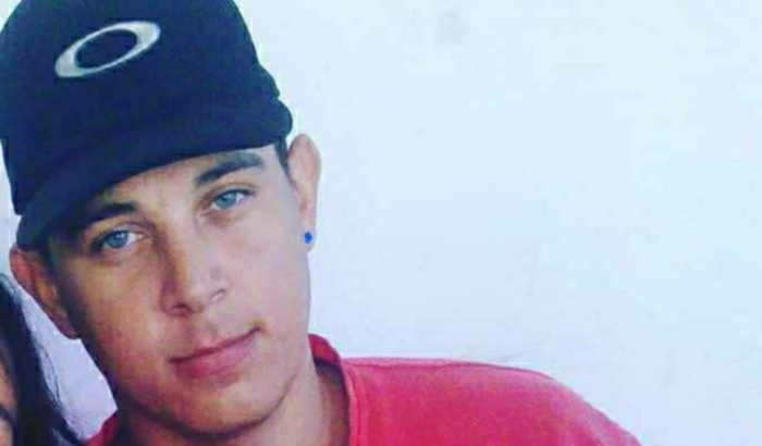 Meu sonho é fazer um transplante capilar