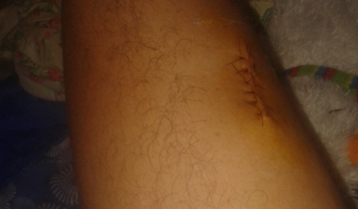 Ajudar um irmão de luta contra o câncer à pagar seu aluguel 