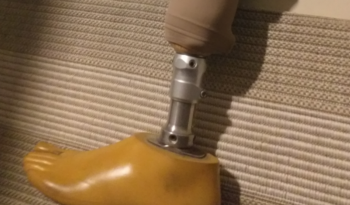 Prótese para perna (perna mecânica) | Vaquinhas online