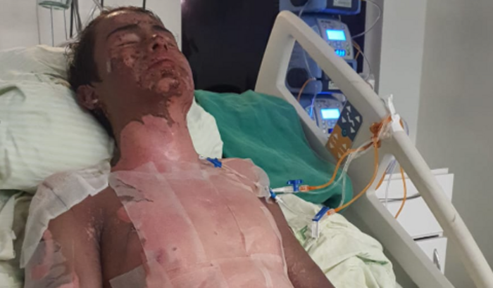 Ajude no tratamento do Caelon - Jovem de 16 anos