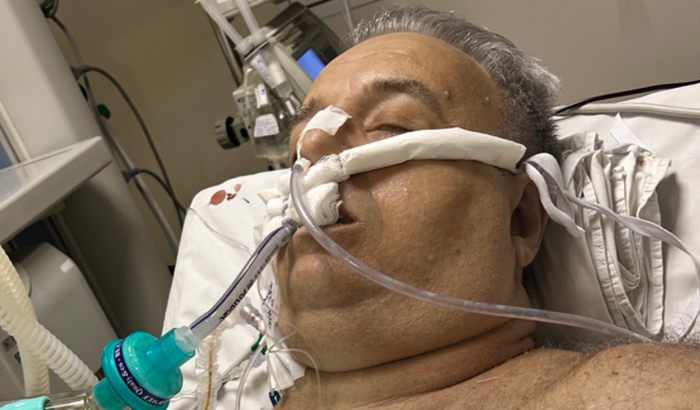 Infelizmente meu esposo nao resistiu ao transplante e morreu