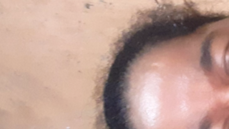 imagem da vaquinha Ajudada para compra uma prótese. Pelo amor de Deus 