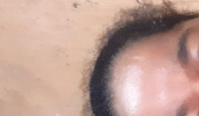 Ajudada para compra uma prótese. Pelo amor de Deus 