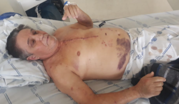 Cirurgia de Emergência