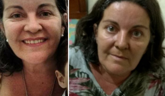 Tratamento Luciane