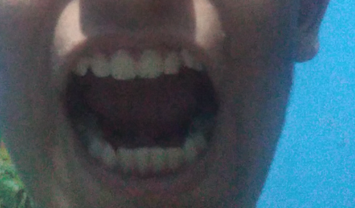 Arrumação dentaria