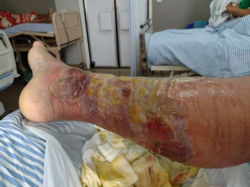 Ajudem na minha recuperação 