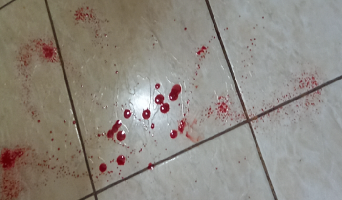 Ajudem meu filho de 4 Patas para uma cirurgia urgente