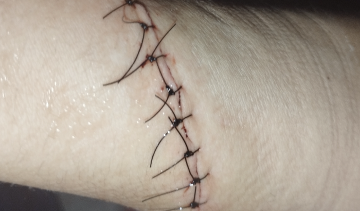 Ramon Fernando meu filho sofreu um acidente